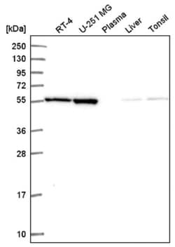 MIPOL1 Antibody, Novus Biologicals 100 &mu;L | Buy Online | Novus Biologicals | Fisher Scientific