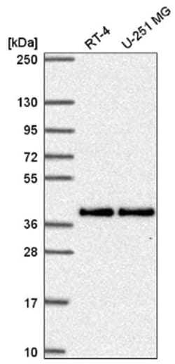 Mitochondrial fission regulator 1 Antibody, Novus Biologicals 100&mu;L;
