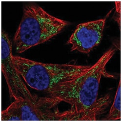 Mitochondrial-processing peptidase subunit beta Antibody, Novus Biologicals:Antibodies:Primary