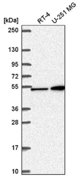 MKK4/MEK4 Antibody, Novus Biologicals:Antibodies:Primary Antibodies