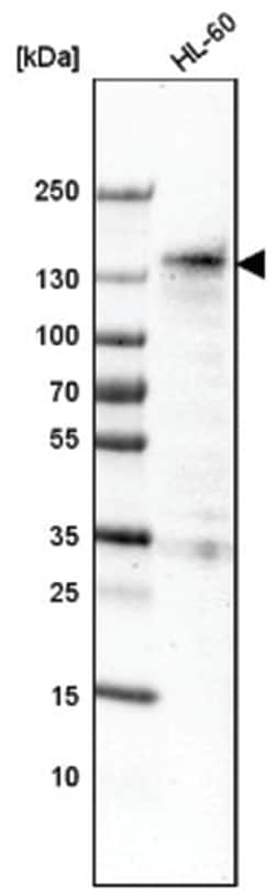 Mkl1 Antibody (CL4281), Novus Biologicals:Antibodies:Primary Antibodies