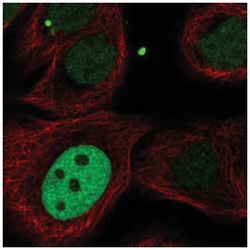 MKLP1 Antibody, Novus Biologicals 25 &mu;L, Unlabeled:Antibodies, Polyclonal