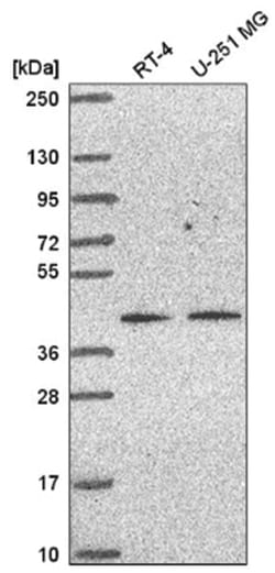 MKP-1/DUSP1 Antibody, Novus Biologicals 100&mu;L; Unlabeled:Antibodies,