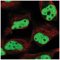 MLH1 Antibody, Novus Biologicals 100&mu;L; Unlabeled:Antibodies, Polyclonal