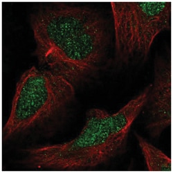 MLH3 Antibody, Novus Biologicals 100&mu;L; Unlabeled:Antibodies, Polyclonal