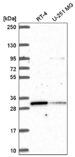 MLX Antibody, Novus Biologicals 100&mu;L; Unlabeled:Antibodies, Polyclonal