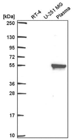 MMP-19 Antibody, Novus Biologicals 25 &mu;L, Unlabeled:Antibodies, Polyclonal