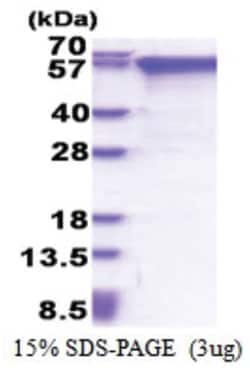 Novus Biologicals&trade;&nbsp;Recombinant Human MMP-2 Protein