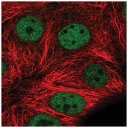 MMS19 like protein Antibody, Novus Biologicals 100&mu;L; Unlabeled:Antibodies,