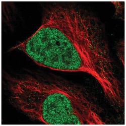 MNAT1 Antibody, Novus Biologicals:Antibodies:Primary Antibodies