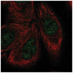 MNK1 Antibody, Novus Biologicals 100 &mu;L | Buy Online | Novus Biologicals | Fisher Scientific