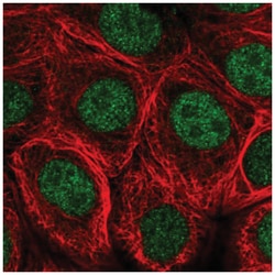 MNX1/HLXB9 Antibody, Novus Biologicals:Antibodies:Primary Antibodies