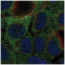 MOCS1 Antibody, Novus Biologicals 100&mu;L; Unlabeled:Antibodies, Polyclonal