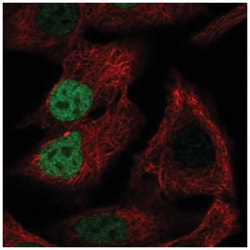 MORC4 Antibody, Novus Biologicals 100&mu;L; Unlabeled:Antibodies, Polyclonal
