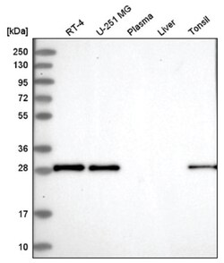 MOSPD3 Antibody, Novus Biologicals 100&mu;L; Unlabeled:Antibodies, Polyclonal