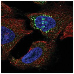 MOT13 Antibody, Novus Biologicals 25 &mu;L, Unlabeled:Antibodies, Polyclonal