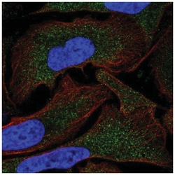 MOV10 Antibody, Novus Biologicals 25 &mu;L:Antibodies, Polyclonal