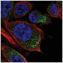 Mover Antibody, Novus Biologicals 100&mu;L; Unlabeled:Antibodies, Polyclonal