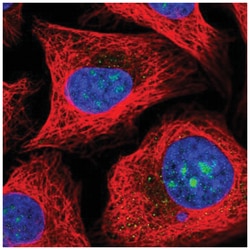 MPHOSPH10 Antibody, Novus Biologicals 100&mu;L; Unlabeled:Antibodies, Polyclonal