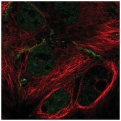MPP7 Antibody, Novus Biologicals 100&mu;L; Unlabeled:Antibodies, Polyclonal
