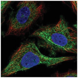 MRCK Antibody, Novus Biologicals 100&mu;L; Unlabeled:Antibodies, Polyclonal