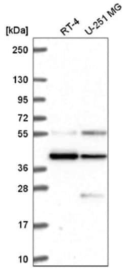 MRG15 Antibody, Novus Biologicals 100&mu;L; Unlabeled:Antibodies, Polyclonal