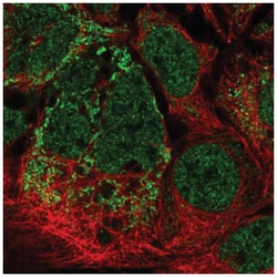 MRPL2 Antibody, Novus Biologicals 25 &mu;L, Unlabeled:Antibodies, Polyclonal
