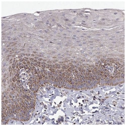 MRPL3 Antibody, Novus Biologicals 100&mu;L; Unlabeled:Antibodies, Polyclonal