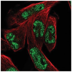 MSANTD3 Antibody, Novus Biologicals 100&mu;L; Unlabeled:Antibodies, Polyclonal