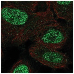 MSX1 Antibody, Novus Biologicals 25 &mu;L, Unlabeled:Antibodies, Polyclonal