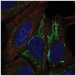 MT-ND4L Antibody, Novus Biologicals 25 &mu;L, Unlabeled:Antibodies, Polyclonal