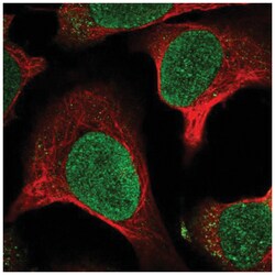 MTBP Antibody, Novus Biologicals 25 &mu;L:Antibodies, Polyclonal