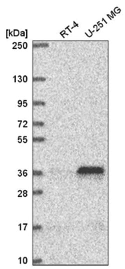 MTERF Antibody, Novus Biologicals 100&mu;L; Unlabeled:Antibodies, Polyclonal