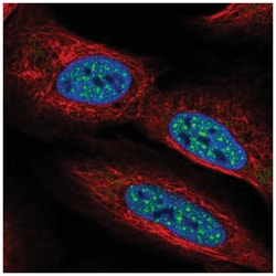 MTGR1 Antibody, Novus Biologicals:Antibodies:Primary Antibodies
