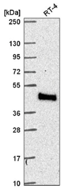 MTMR9 Antibody, Novus Biologicals 100&mu;L; Unlabeled:Antibodies, Polyclonal
