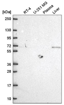 MTSS1 Antibody, Novus Biologicals 100&mu;L; Unlabeled:Antibodies, Polyclonal
