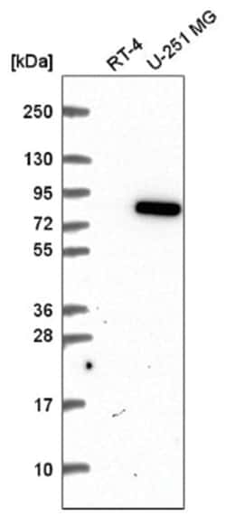 MTSS1L Antibody, Novus Biologicals 100&mu;L; Unlabeled:Antibodies, Polyclonal