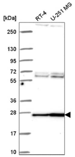 mtTFA Antibody, Novus Biologicals 25 &mu;L; Unconjugated:Antibodies, Polyclonal