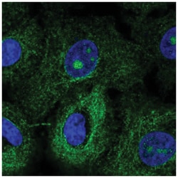 MTUS1 Antibody, Novus Biologicals 100&mu;L; Unlabeled:Antibodies, Polyclonal