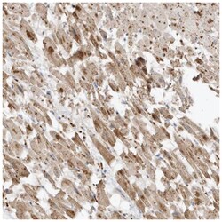 MTUS2 Antibody, Novus Biologicals 25 &mu;L:Antibodies, Polyclonal