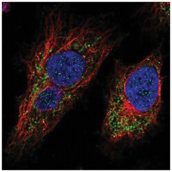 MTX3 Antibody, Novus Biologicals 25 &mu;L, Unlabeled:Antibodies, Polyclonal