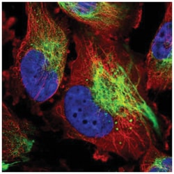 Mucolipin 2 Antibody, Novus Biologicals 25 &mu;L:Antibodies, Polyclonal