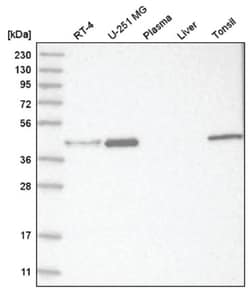 Muscleblind-like 1 Antibody, Novus Biologicals:Antibodies:Primary Antibodies
