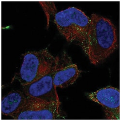 MYO16 Antibody, Novus Biologicals 100&mu;L; Unlabeled:Antibodies, Polyclonal