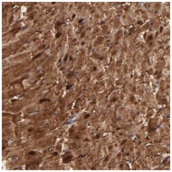 Myoglobin Antibody, Novus Biologicals 0.1mL; Unlabeled:Antibodies, Polyclonal