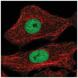 MYPOP Antibody, Novus Biologicals 25 &mu;L | Buy Online | Novus Biologicals | Fisher Scientific