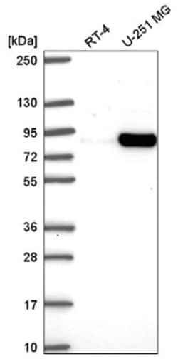 MYSM1 Antibody, Novus Biologicals 100&mu;L; Unlabeled:Antibodies, Polyclonal