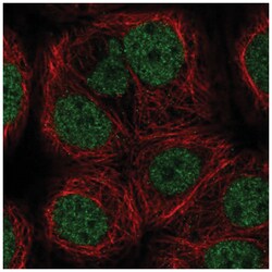 MYST1 Antibody, Novus Biologicals 100&mu;L; Unlabeled:Antibodies, Polyclonal