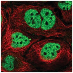 N4BP2L2 Antibody, Novus Biologicals 25 &mu;L | Buy Online | Novus Biologicals | Fisher Scientific