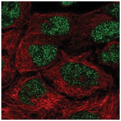 NAALADase-2/NAALAD2 Antibody, Novus Biologicals 100 &mu;L | Buy Online | Novus Biologicals | Fisher Scientific